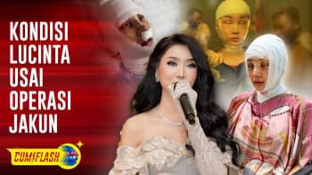 Heboh! Kondisi Lucinta Luna Usai Operasi Pemotongan Leher & Operasi Tulang Ekor Bikin Netizen Takut